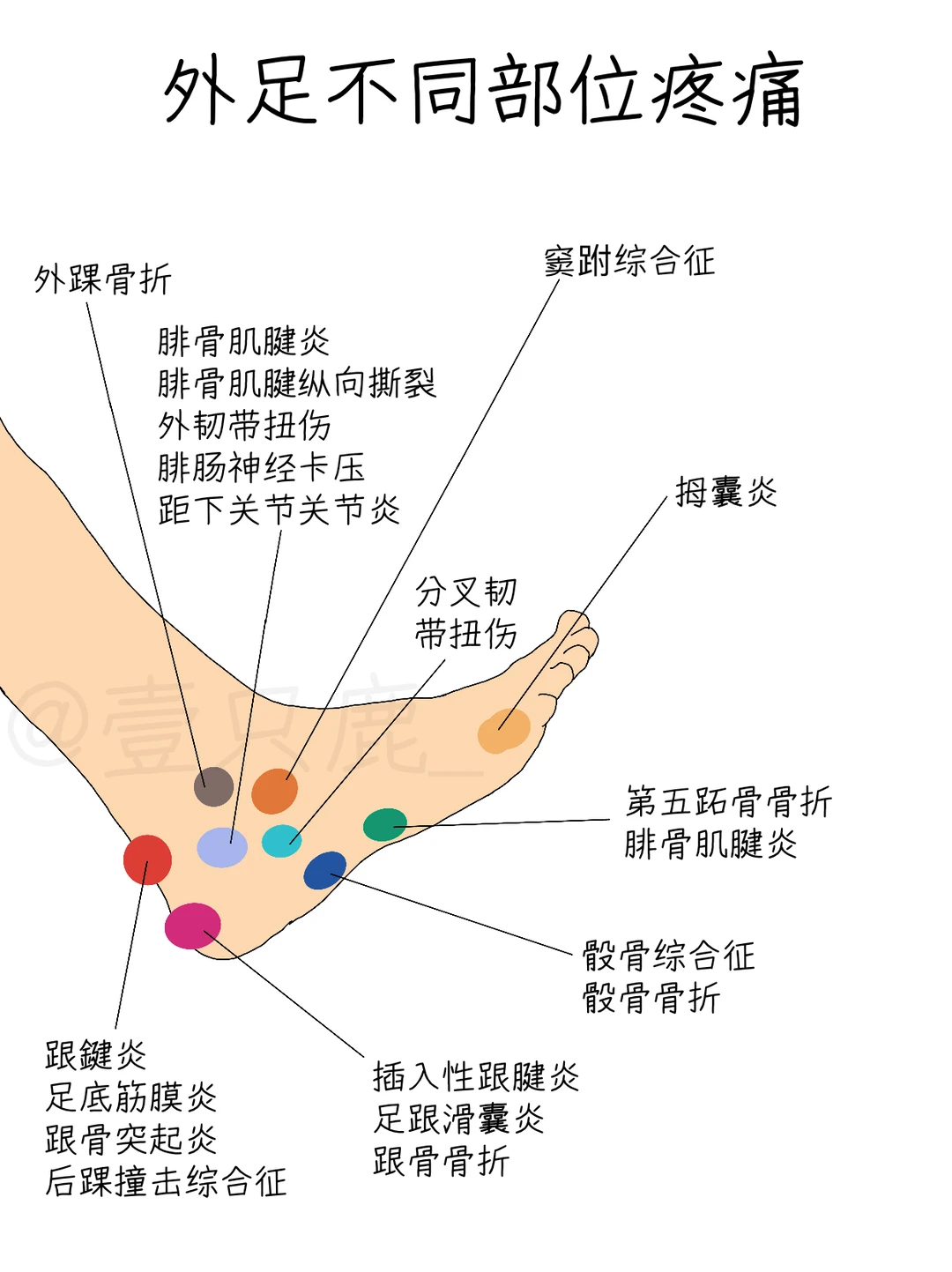 外足不同部位疼痛，究竟怎么回事？