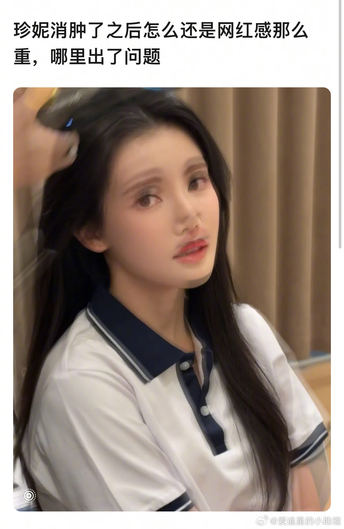 孙珍妮的脸消肿后网红感依然很重吗？​​​