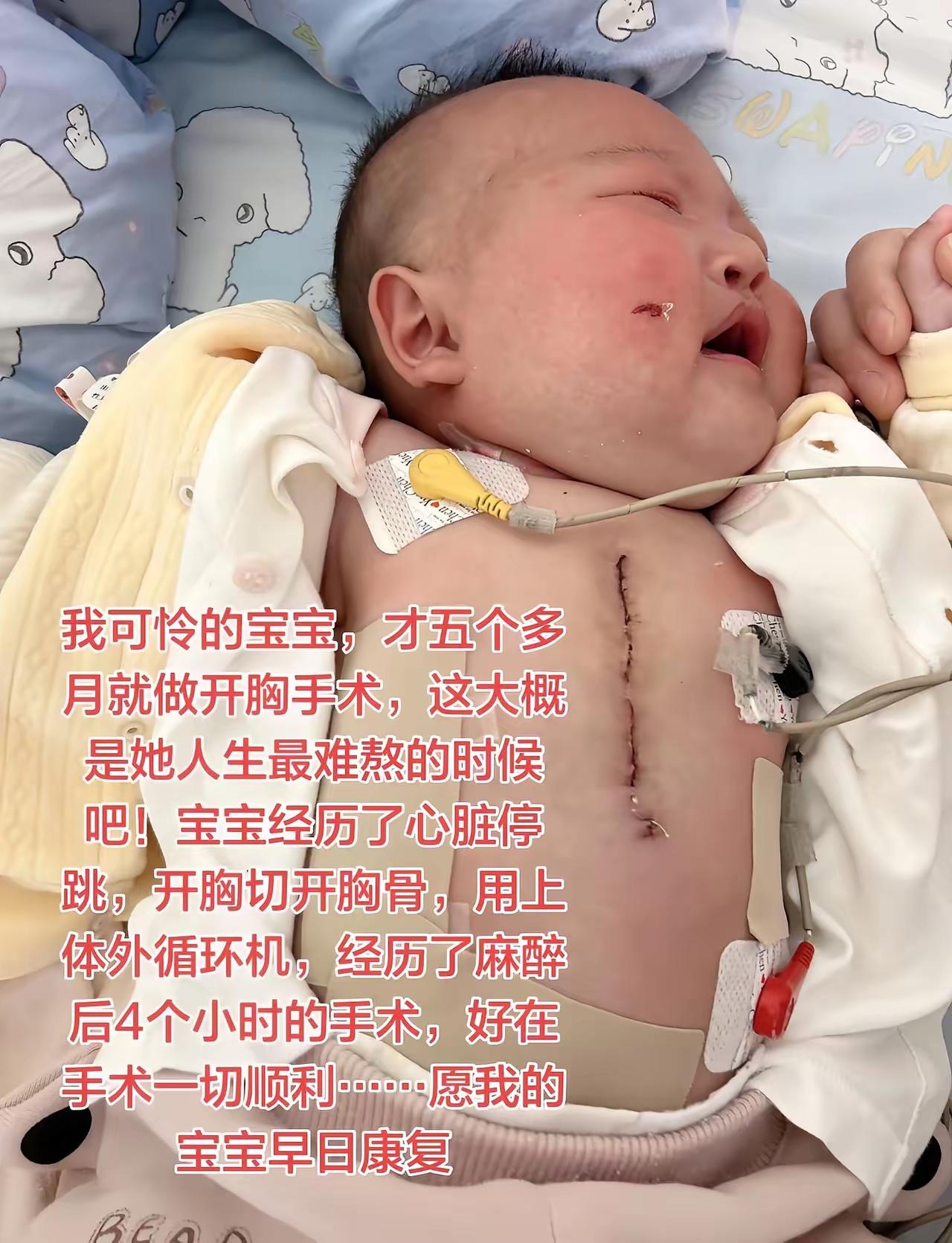 愿天下所有宝宝健康成长……5个月的宝宝，开膛破肚，先天性心脏病……孩子是