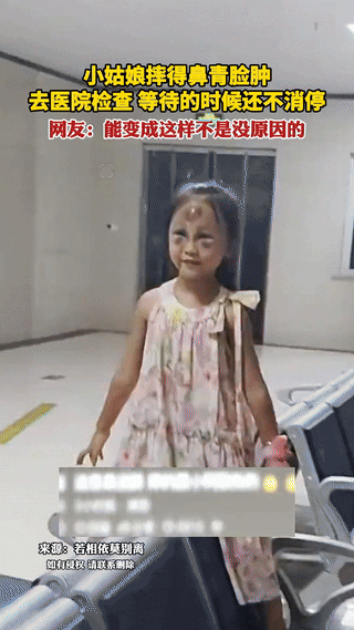 我的天呐！小女孩从沙发顶摔下来脸肿成发面饼，妈妈抱着她狂奔医院，魂儿都吓飞了