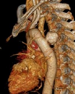 腹部异常可不能轻视。产后妈妈要格外留意，若肚脐下方有硬块，按压疼且持续超两周，可