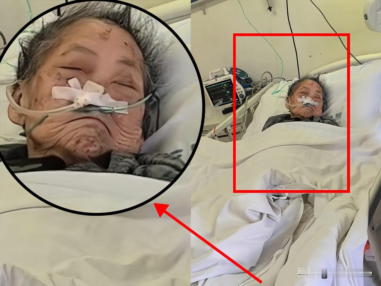 70岁老人需要抢救，老人儿子问需要多少钱，医生说15万，他儿子一秒都没有犹豫，说