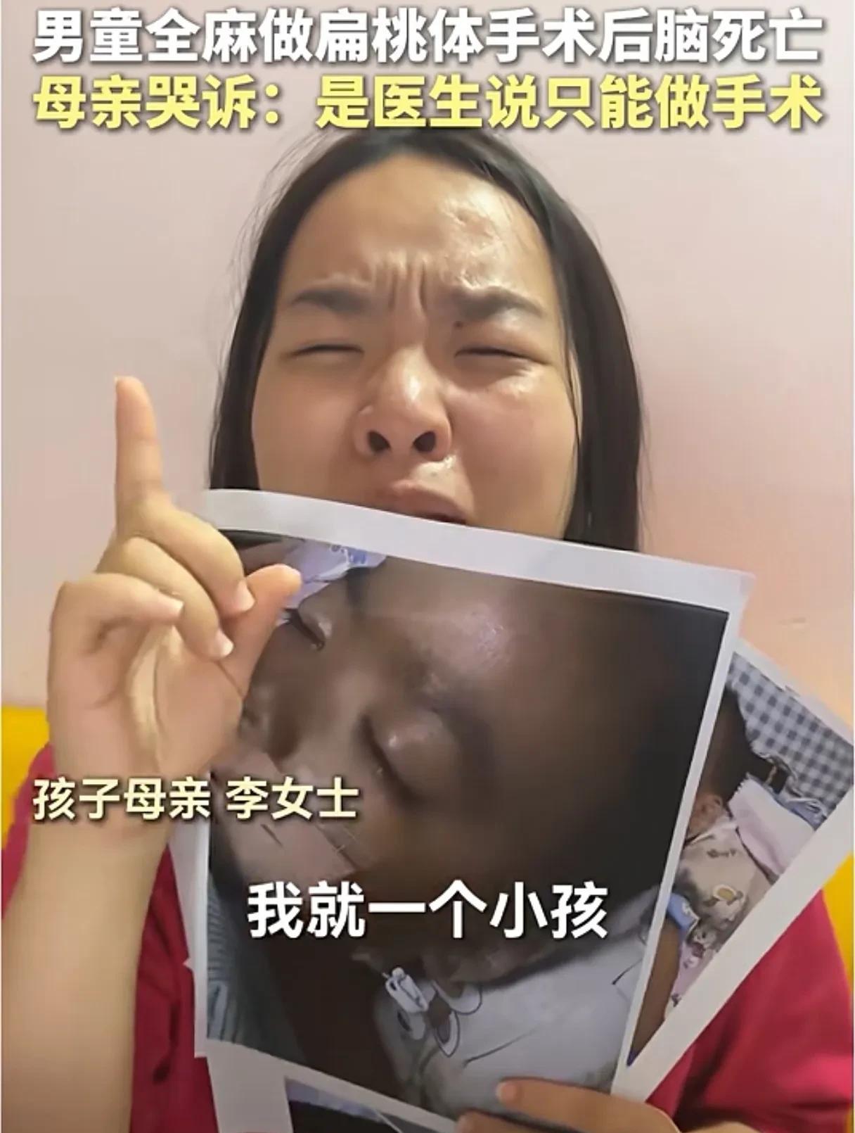 3岁男童扁桃体术后脑死亡，其母亲7月15日再发声：“"孩子全身插管，身上手上多处