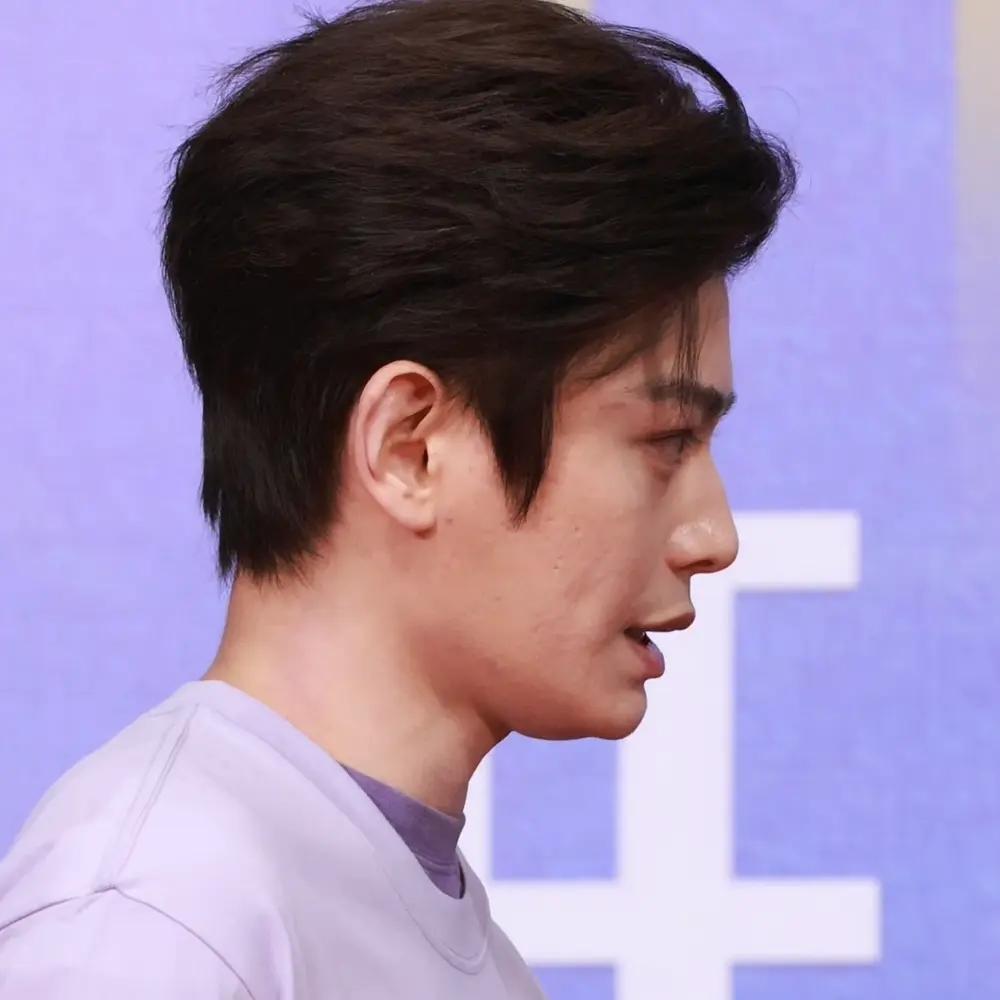 丁禹兮这侧脸和皮肤，真的不能医美吗......痘坑是不是很难改善啊？都这么有钱