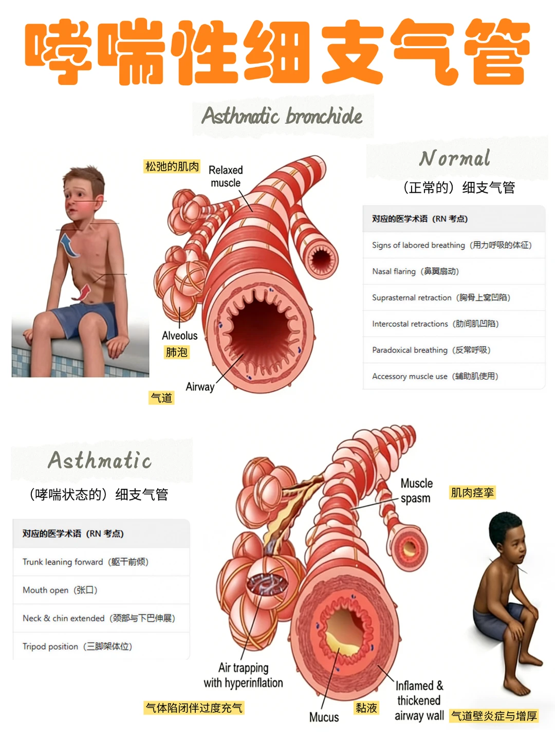 备考RN/哮喘性细支气管！！学！！内容