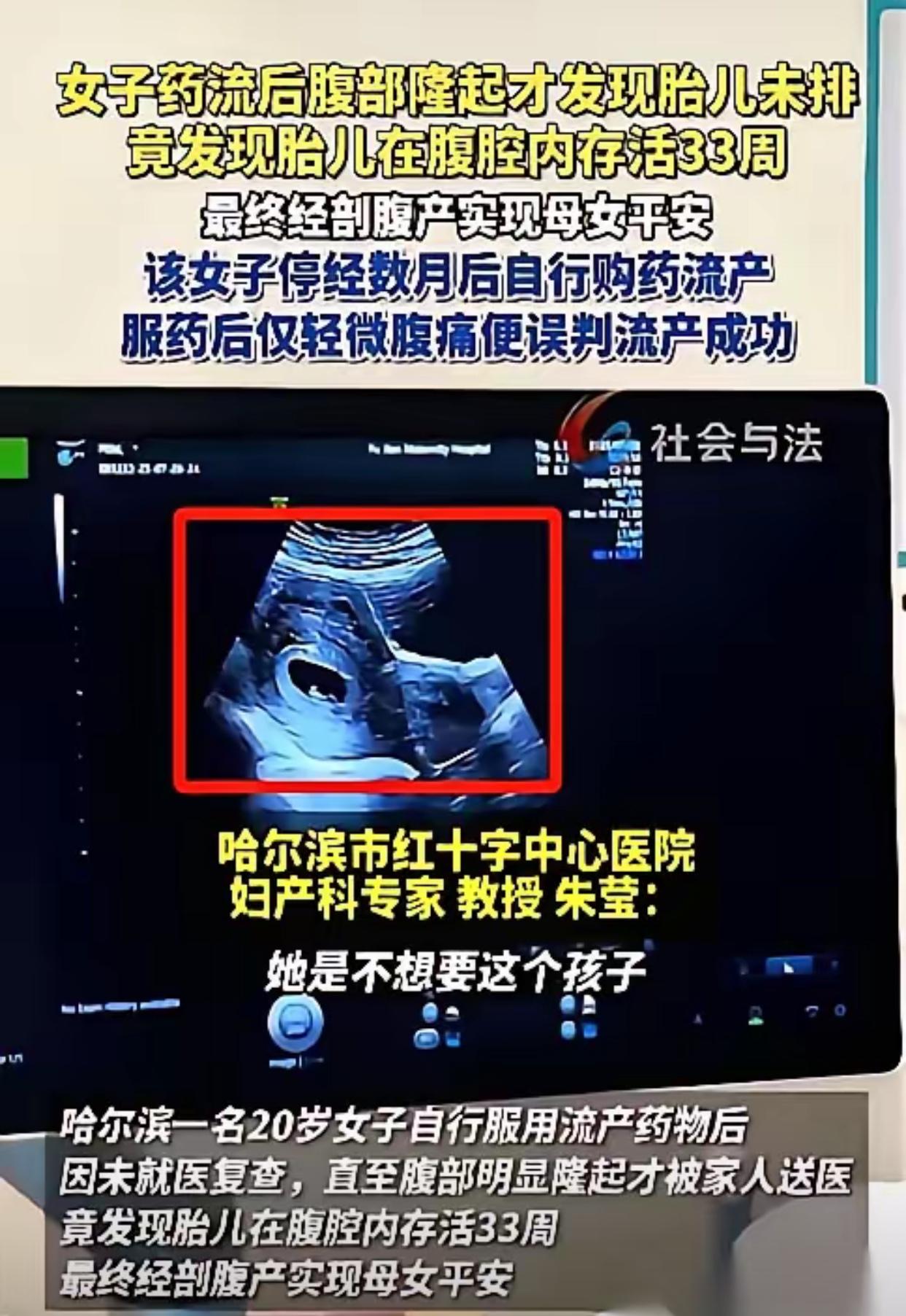 哈尔滨一个20岁的姑娘，吃药想把孩子打掉。结果B超探头一放上去，医生当场就傻了。