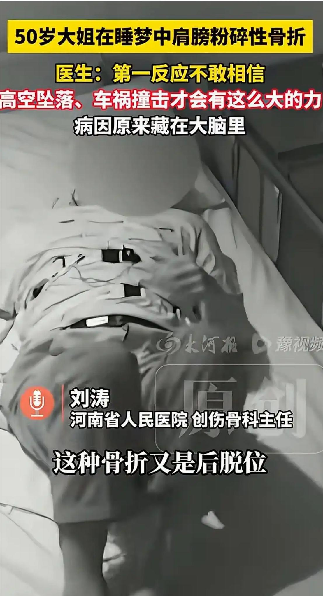 50岁女子睡梦中骨折，无碰无摔，医生揭秘：凶手藏在日常里离谱！50岁张阿姨半