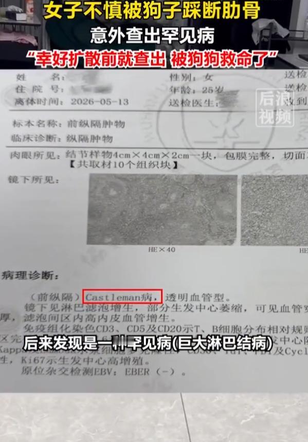 “汪汪队立大功！”7月22日报道，北京，一女子养了条德牧，玩耍时被自家八十斤德牧