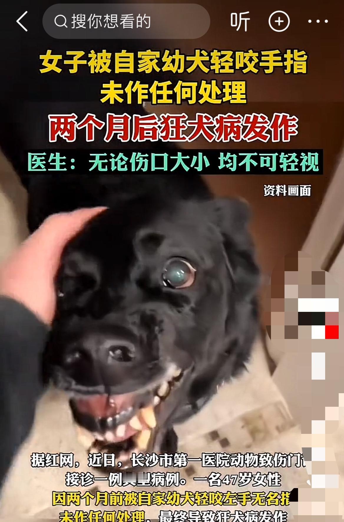 “两个月前被自家狗咬了，现在人没了？”在长沙，这样一则消息让不少爱狗人士和普通市