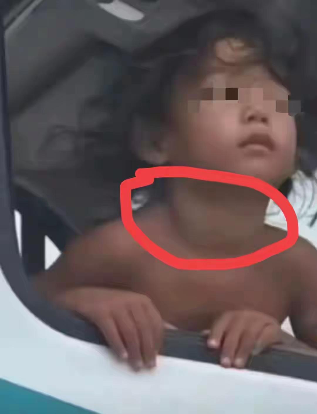 野人小男孩后续:落户北京，不再爬行，母亲状态曝光，网友操心关于“野人小男孩