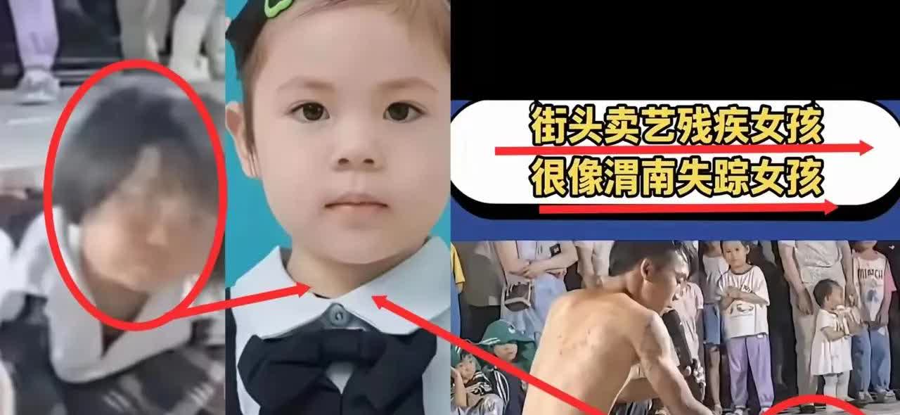 一组照片曝光了一个健康的小女孩被人贩子折磨至残疾的惨状，网友们看了之后非常愤怒，