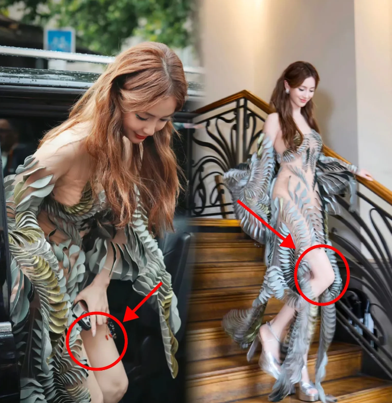 黄晓明你糊涂啊，虽然Angelababy有一个身体上的问题，这个问题也让她在时装