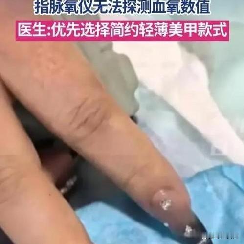 28岁姑娘心跳骤停，却因这个被卡在鬼门关！医生：第一次见这种情况说个真事儿，