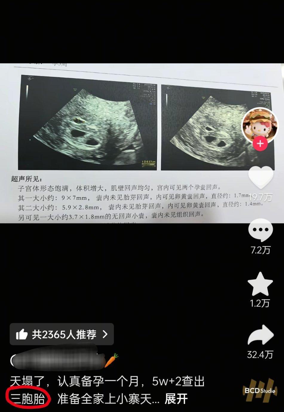 现在这么多人生多胞胎的玄学解释[笑着哭]​​​