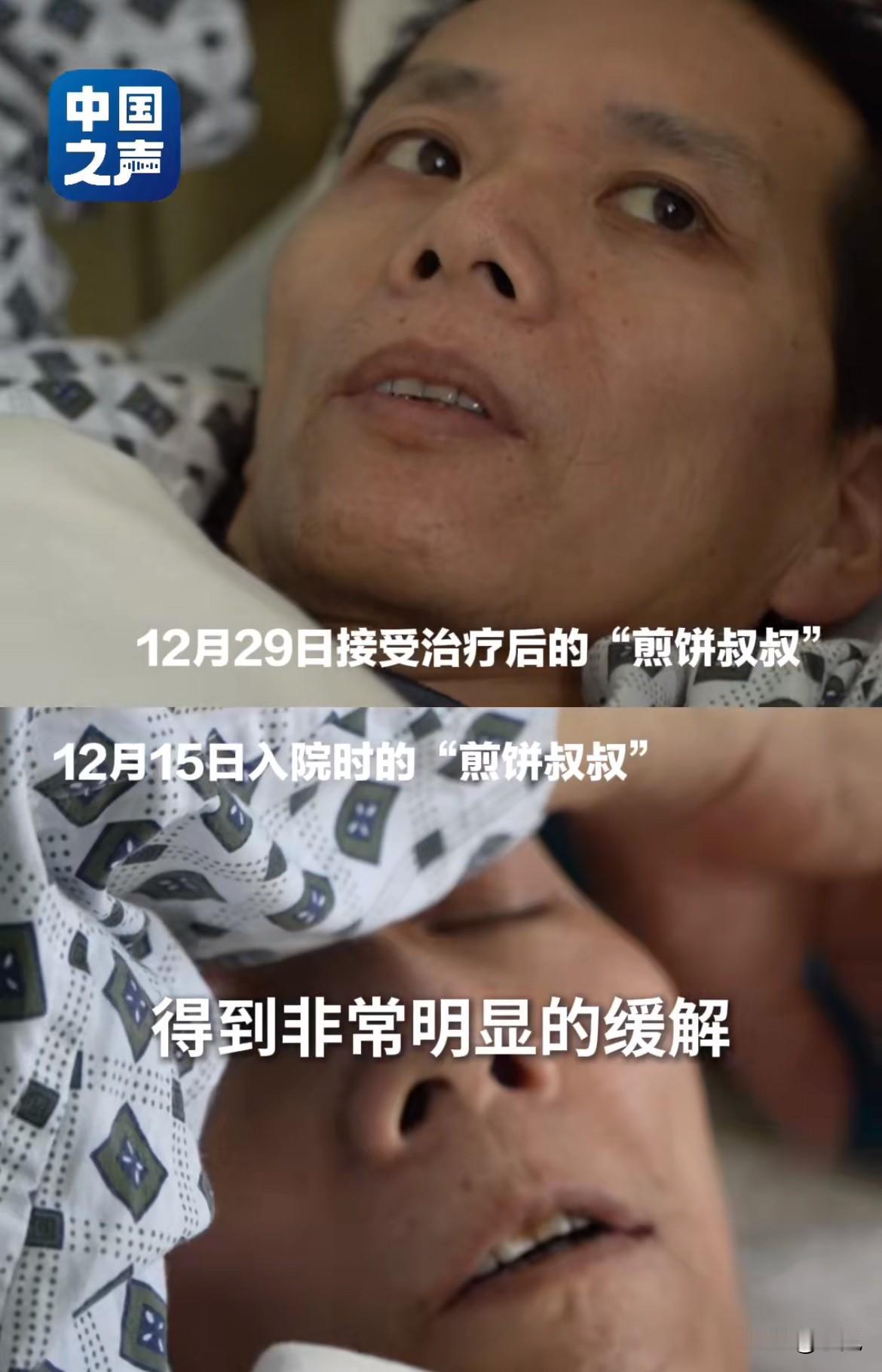 煎饼叔叔出院了！就是那个让整条小吃街摊主，默默把收款码都换成同一个的煎饼叔叔。