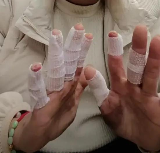 一双手几乎烧废，副驾没救出来……最近一段云南货车司机火海拽出3人的视频刷屏网络。