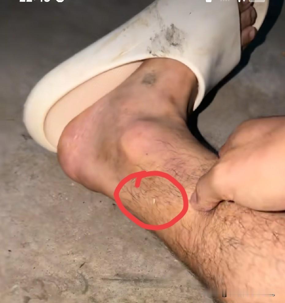 小故事！大家看看这是半熟的两只脚，傍晚半熟来到李佳这边家里他的妹妹