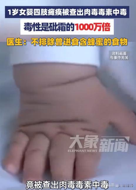 “悲剧还是发生了！”近日，福建福州，1岁女婴吃完蜂蜜后，突发四肢无力，迅速瘫痪，