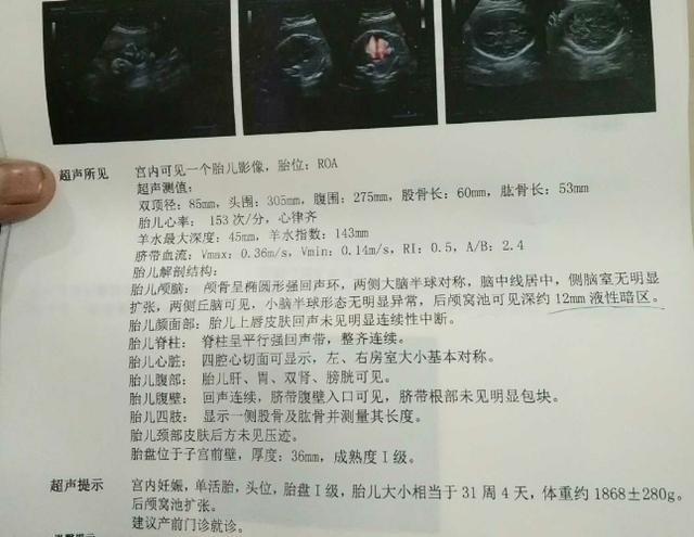 1月5日, 顺产男宝一枚, 要的来接, 进来的都好孕