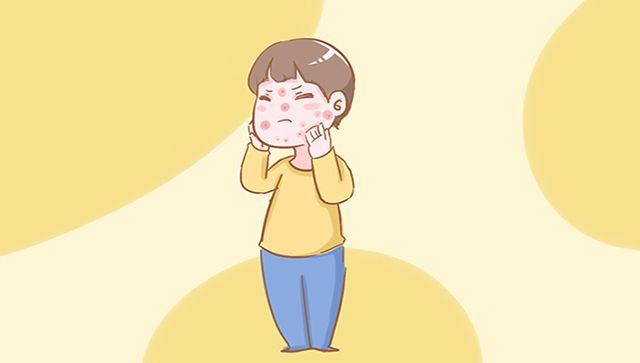 宝宝很容易轻微过敏, 妈妈不能放松警惕, 要能识别出这些过敏源