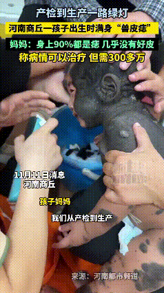 “产检一路绿灯，却换来宝宝满身‘兽皮’！”河南一名宝妈满心期待迎接新生儿，所有