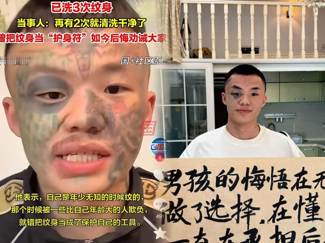 13岁在脸上纹图案‘护体’20岁为洗掉它痛到咬牙广东06年男孩夏朝勇的经历，