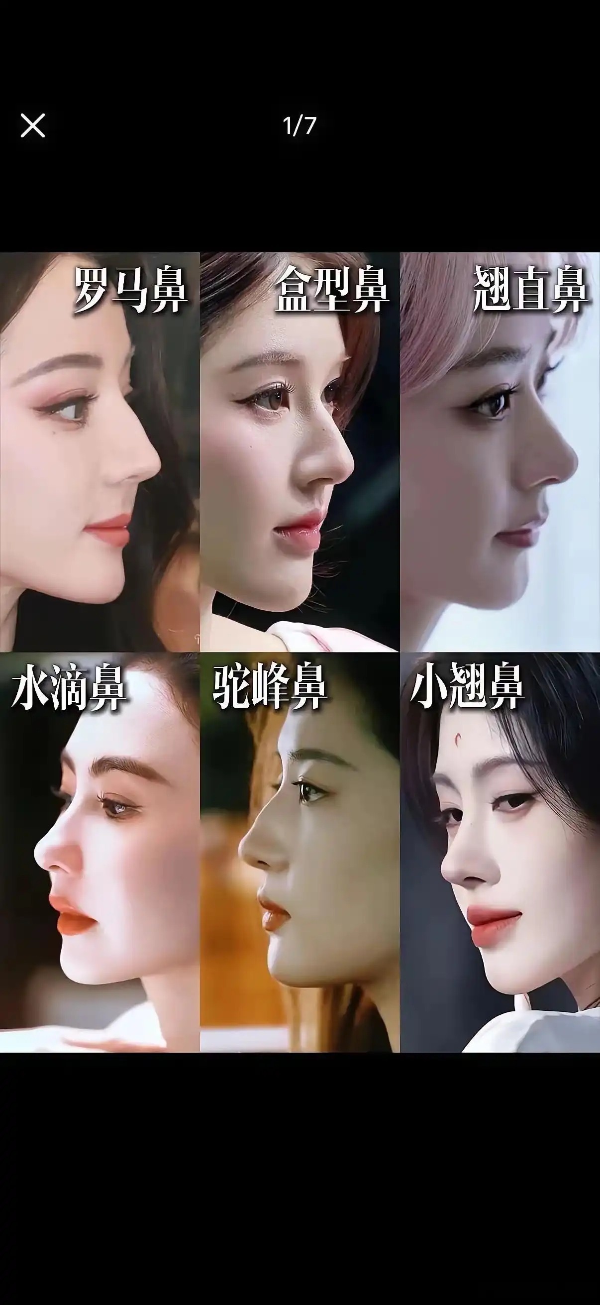 内娱这几种鼻子，你最想要哪种