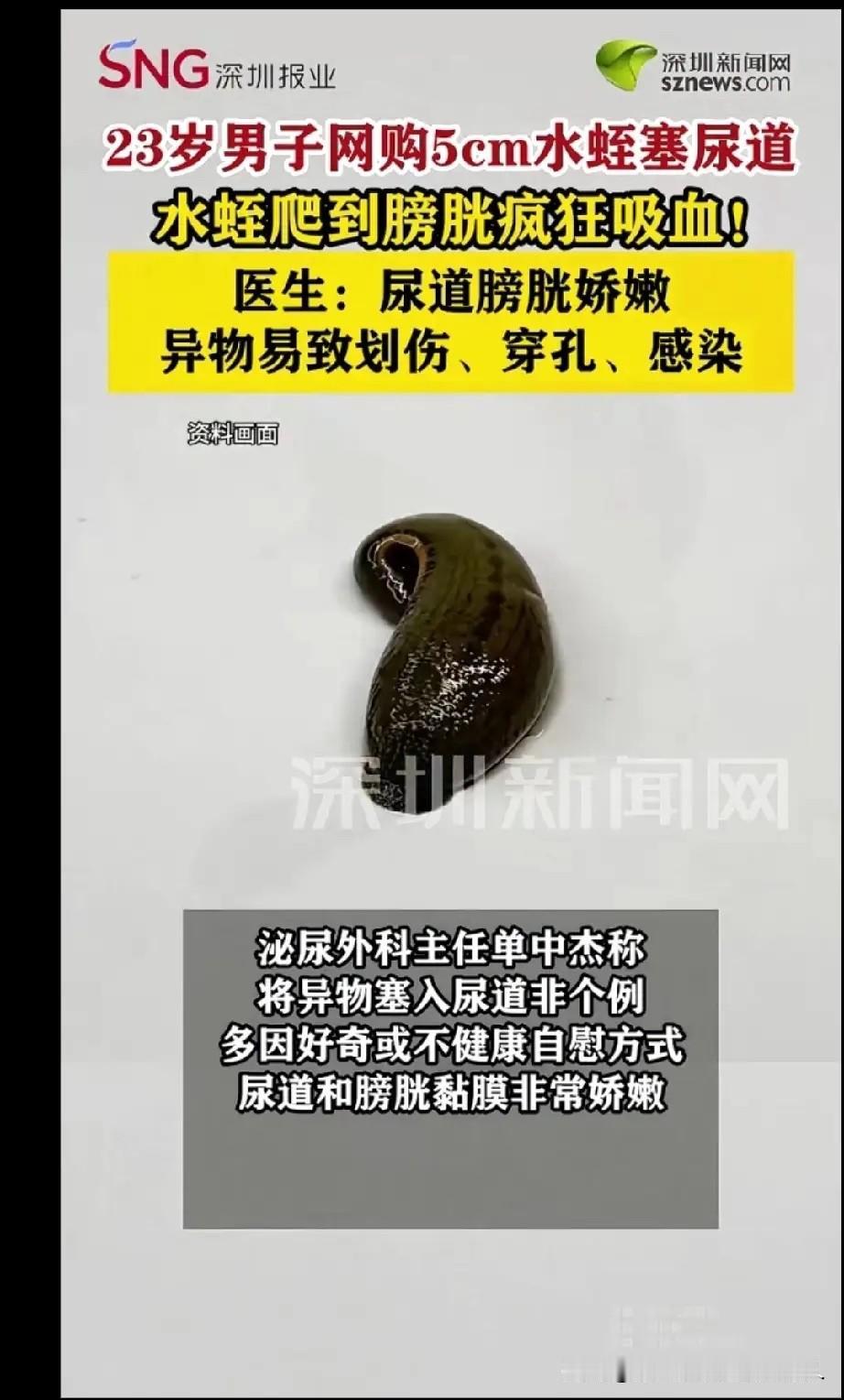 真是让人听了都觉得后背发凉！1月6日，郑州某医院接诊了一个让人“叹为观止”的