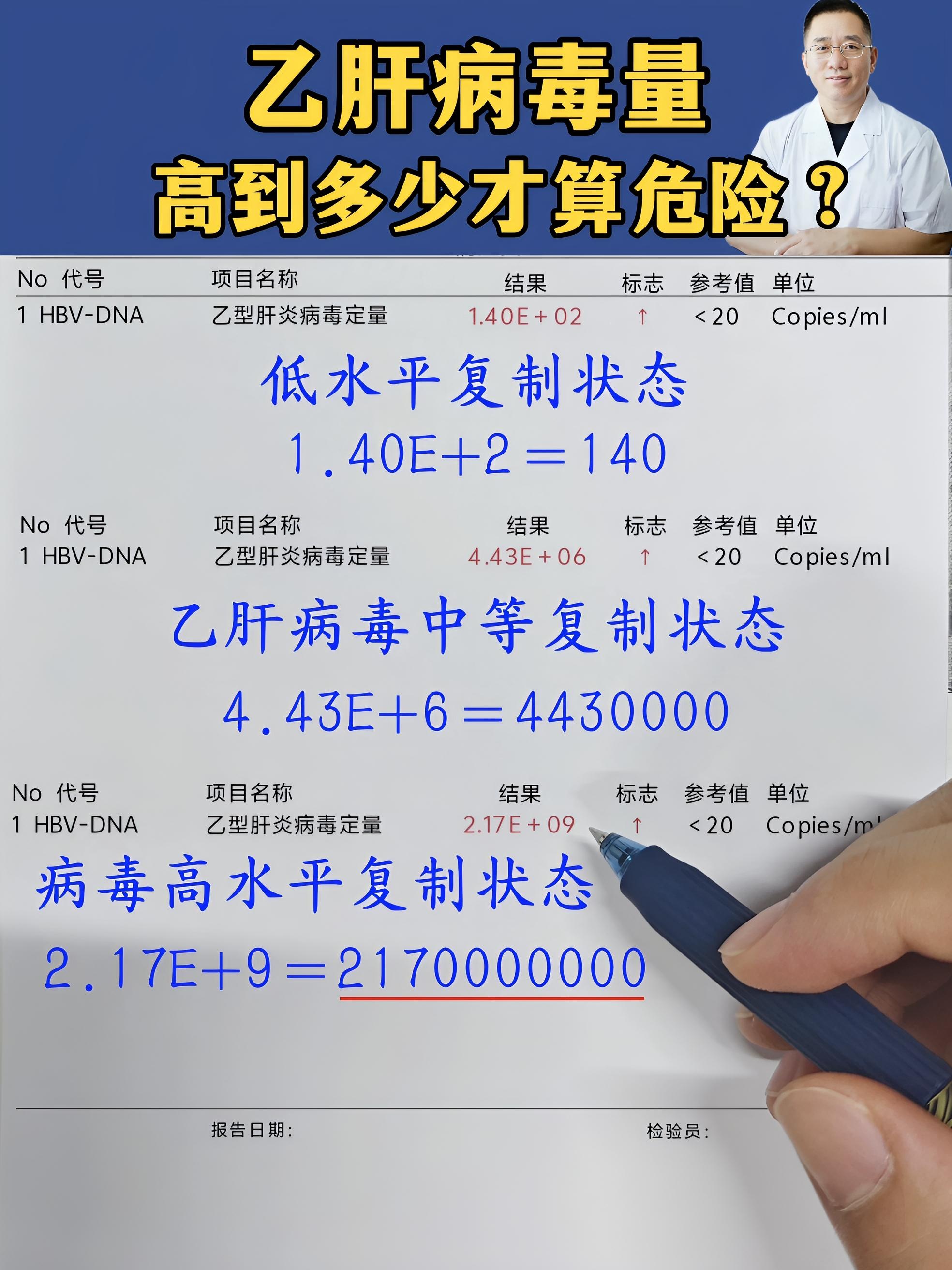 乙肝病毒量，多高才算危险呢？ 首先，乙肝病毒量被划分为3个等级： 1...