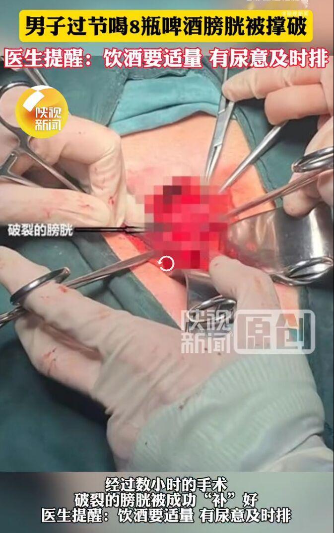 过节聚餐喝酒本是乐事，可陕西西安的王先生却因此遭了大罪。他和朋友聚餐时不知不觉喝