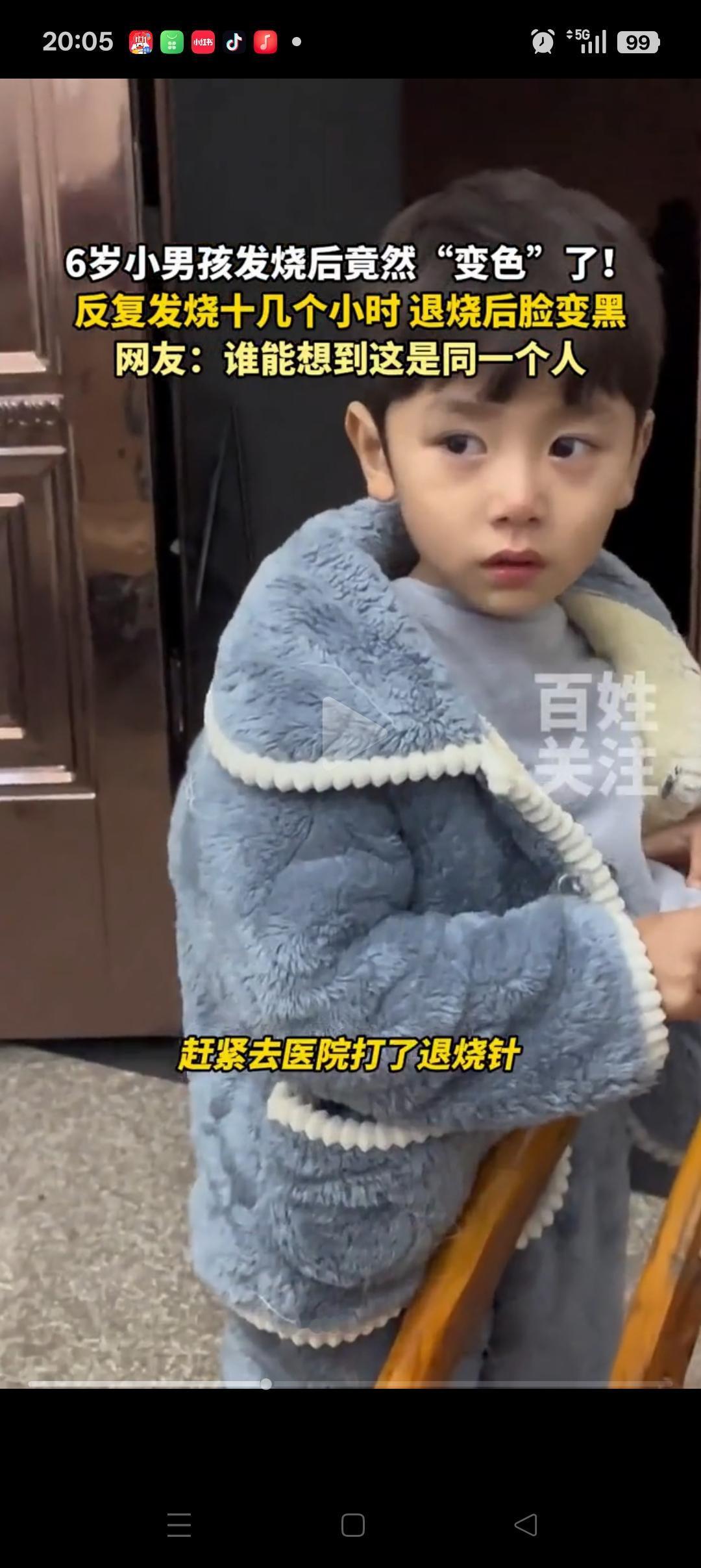 “彻底说不清楚了”，湖南，6岁男孩反复发烧十几个小时后，脸从白色直接变成了黑色。