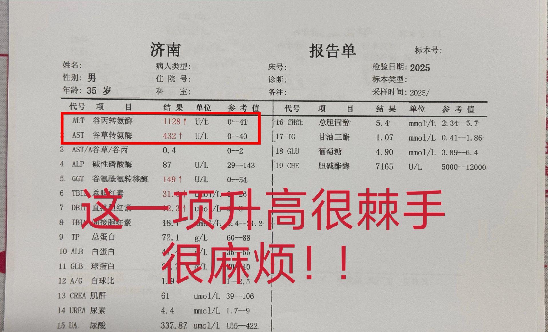 前段时间来了位乙肝小伙，今年35岁，转氨酶1000+，据说经常反复升高...