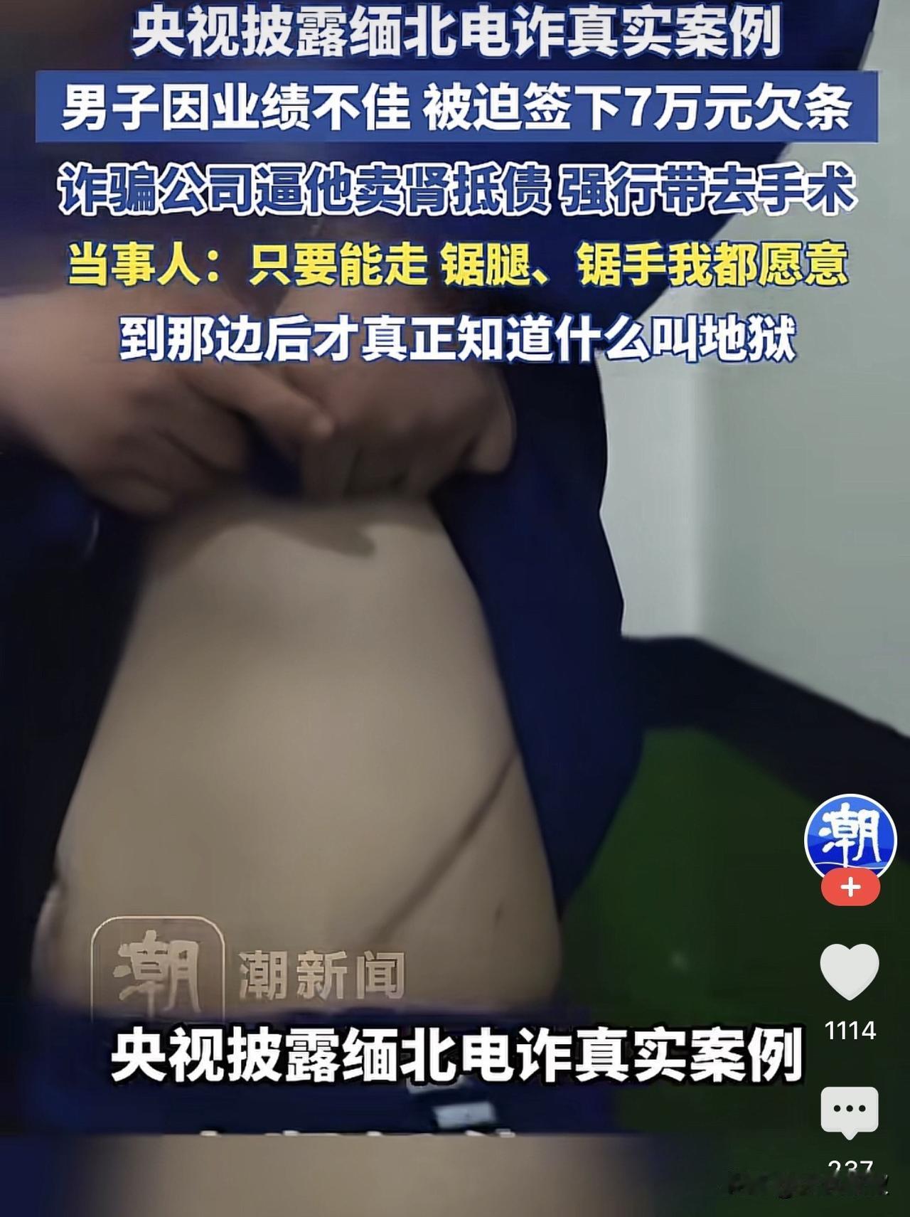 你配型成功了。说这话的，不是医生对着躺在病床上，急需肾源的尿毒症患者。而是园区一