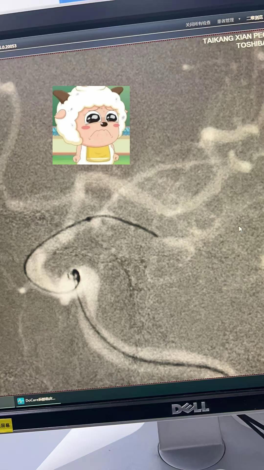 小羊啊，没长大。