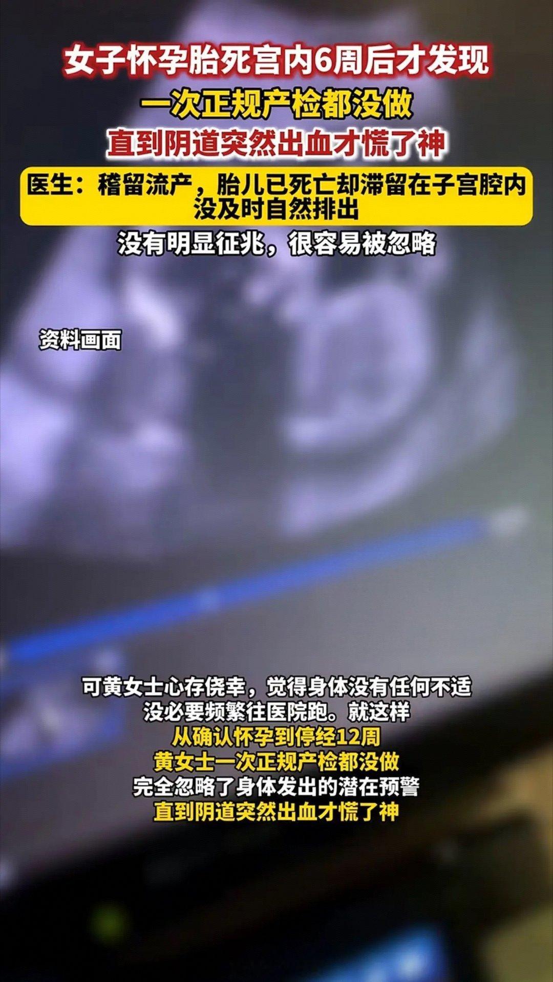 女子怀孕胎死宫内6周后才发现太揪心了！😭孕期最绝望的事莫过于此宝宝早已停止发育