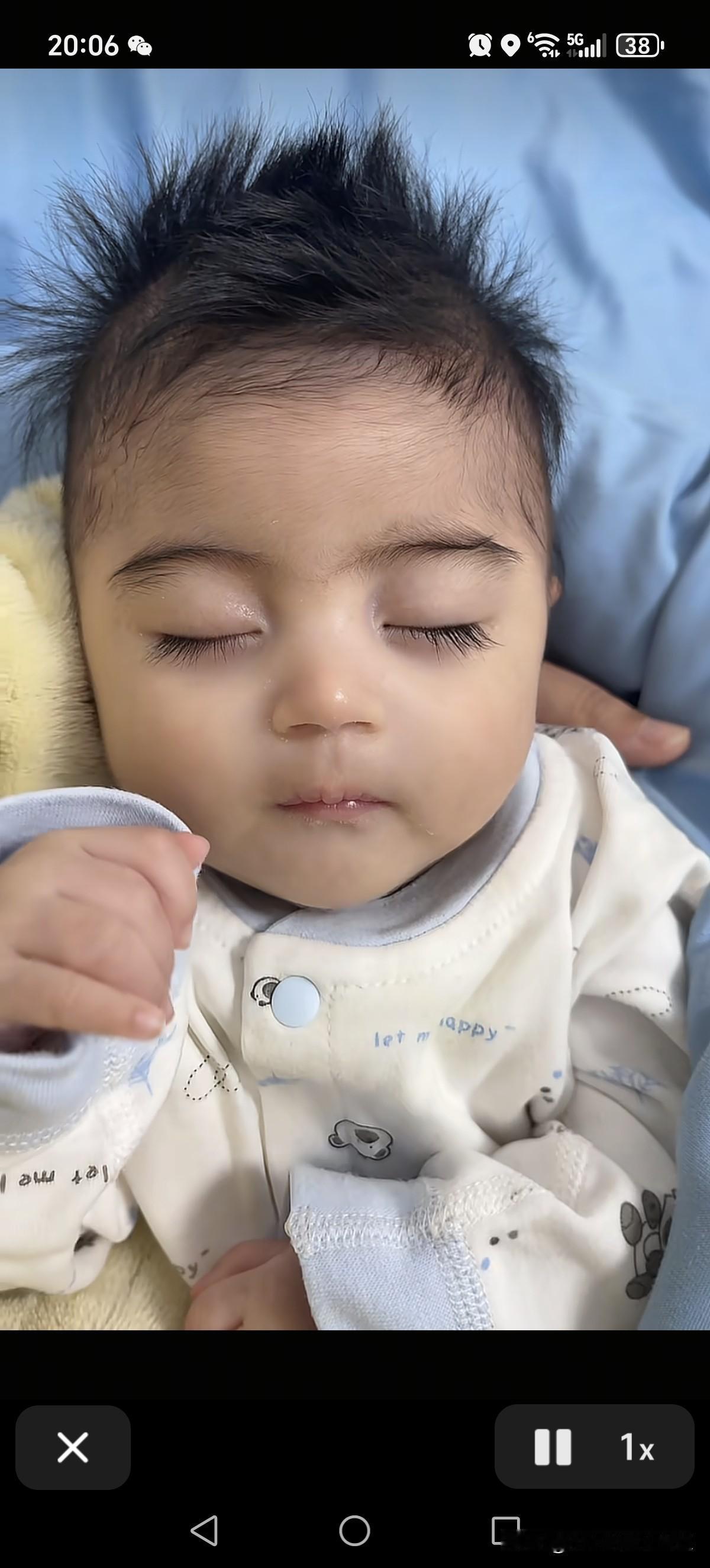 前段时间河南的一位宝妈晒出自己三个月9斤重婴儿，评论区都说这个孩子很像德朗热综合