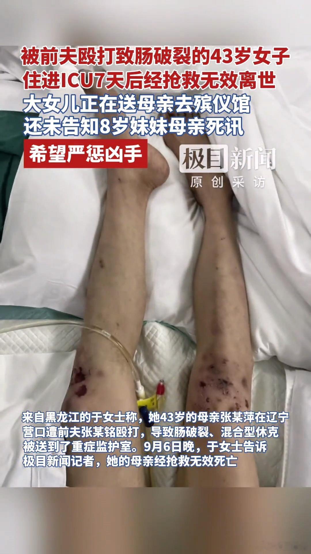 43岁女子被前夫殴打致肠破裂，住进ICU后7天后抢救无效去世，此前的离婚证照片上