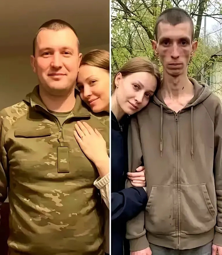 乌克兰兵打仗前后，变化真大啊！想象一下，一个生龙活虎的小