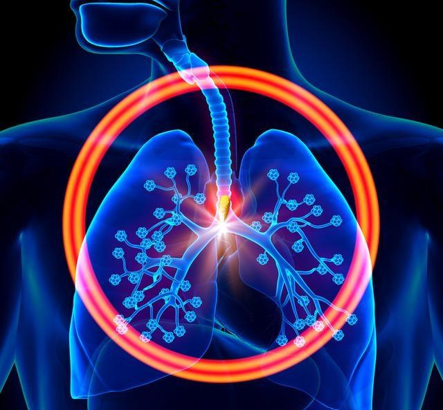 4月15日，江苏疾控发布2025年度癌症发病数据。2025年，江苏癌