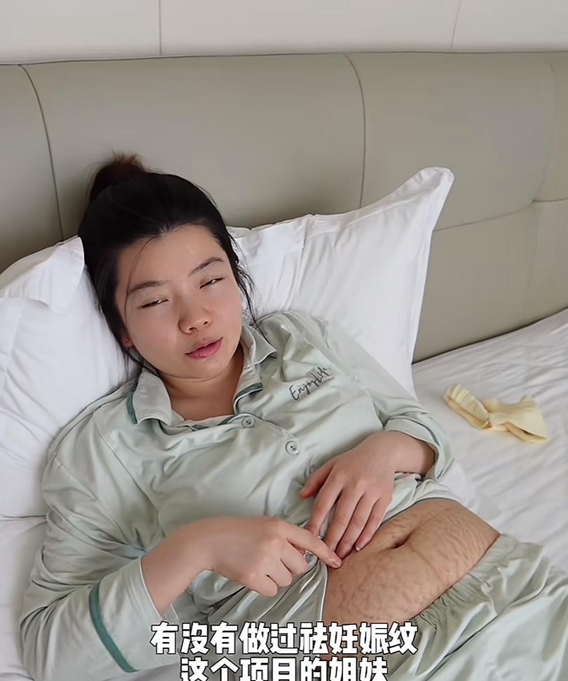 怀孕生孩子对女人身体的影响真的太大了。黄喂喂之前有马甲线，现在肚子上长满了妊娠