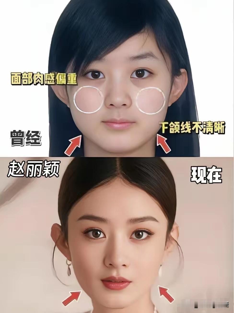 娱乐圈里的女明星，脸型变化是常态。有的人婴儿肥褪去了变得精致了，有的人因为角色需