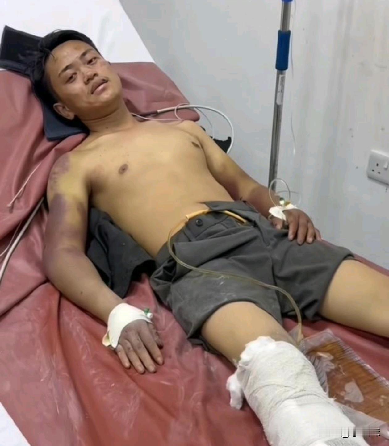 12月25日，涉嫌绑架残害同胞的非洲洋洋被坦桑尼亚警方抓捕落网，在审讯时被打耳光