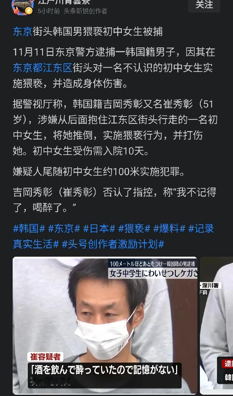 这种事，花点钱呗，日本又不是没有。