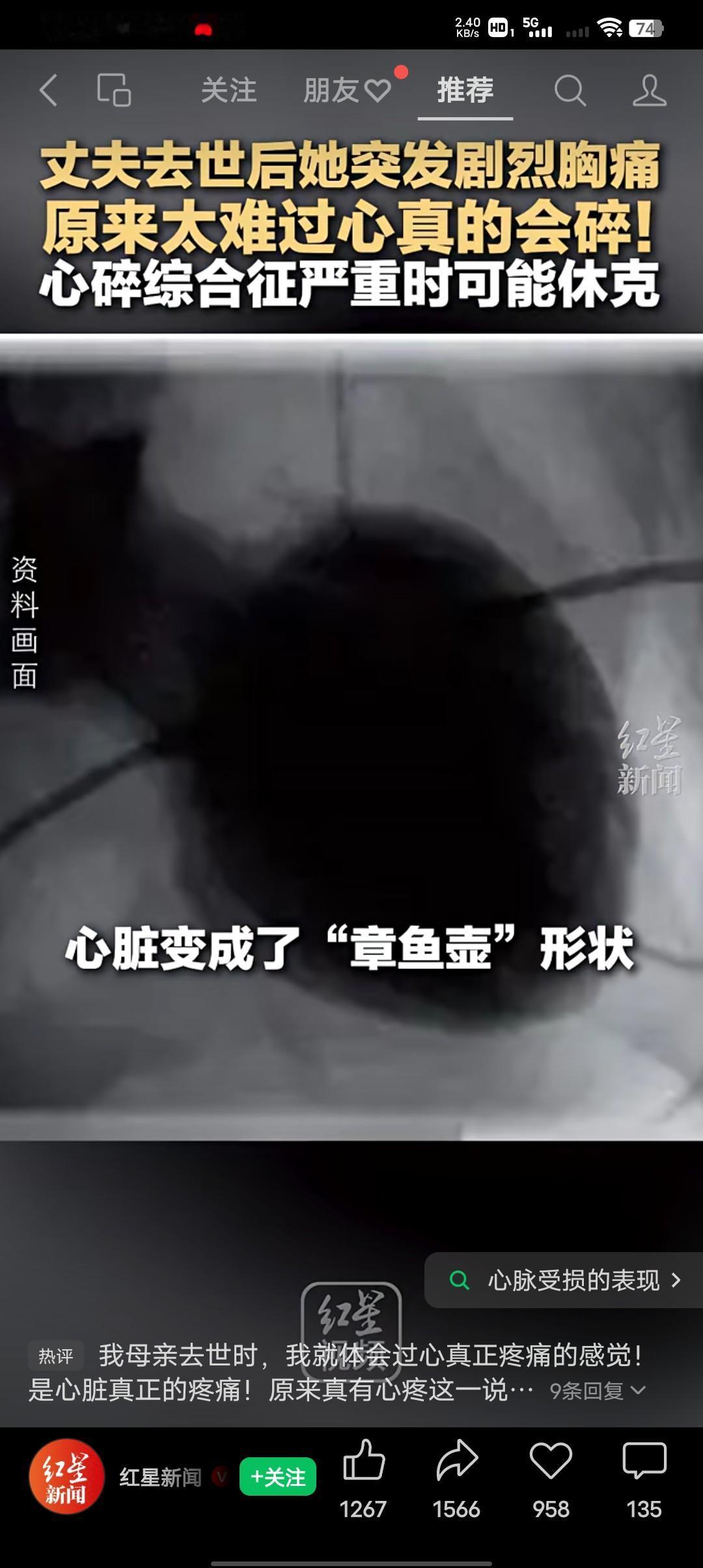 原来太难过心真的会碎！72岁的李阿姨身体一直很硬朗，身体状况一直很好，在老伴去