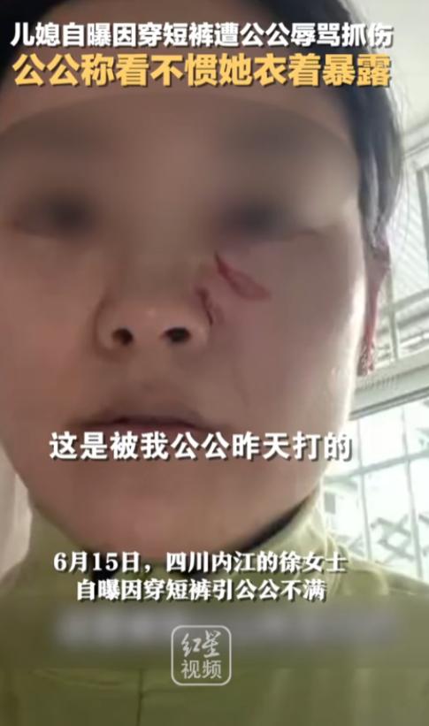 “清官难断家务事！”四川，一儿媳因天气热穿了条白色短裤，竟遭年长公公指着鼻子骂“
