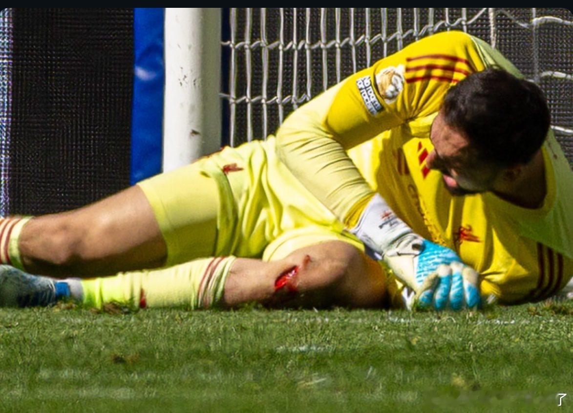 马马达这伤口的口子有点大啊（害怕别点大图）