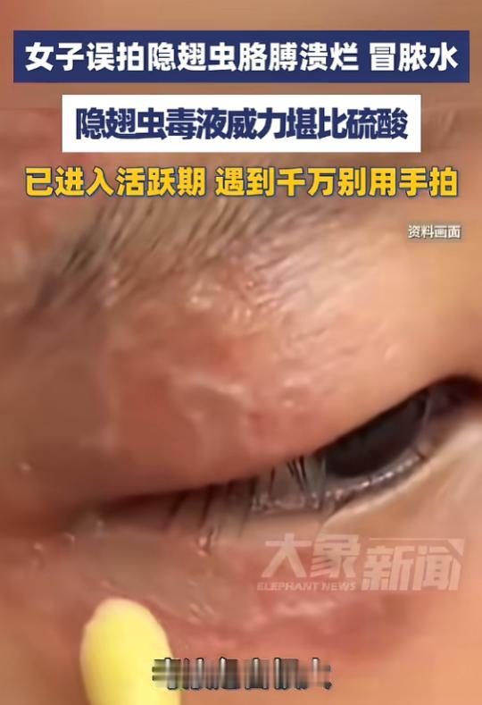 "悲剧还是发生了！"5月29日报道，浙江义乌，一女子见窗边有小虫，随手就给拍死了