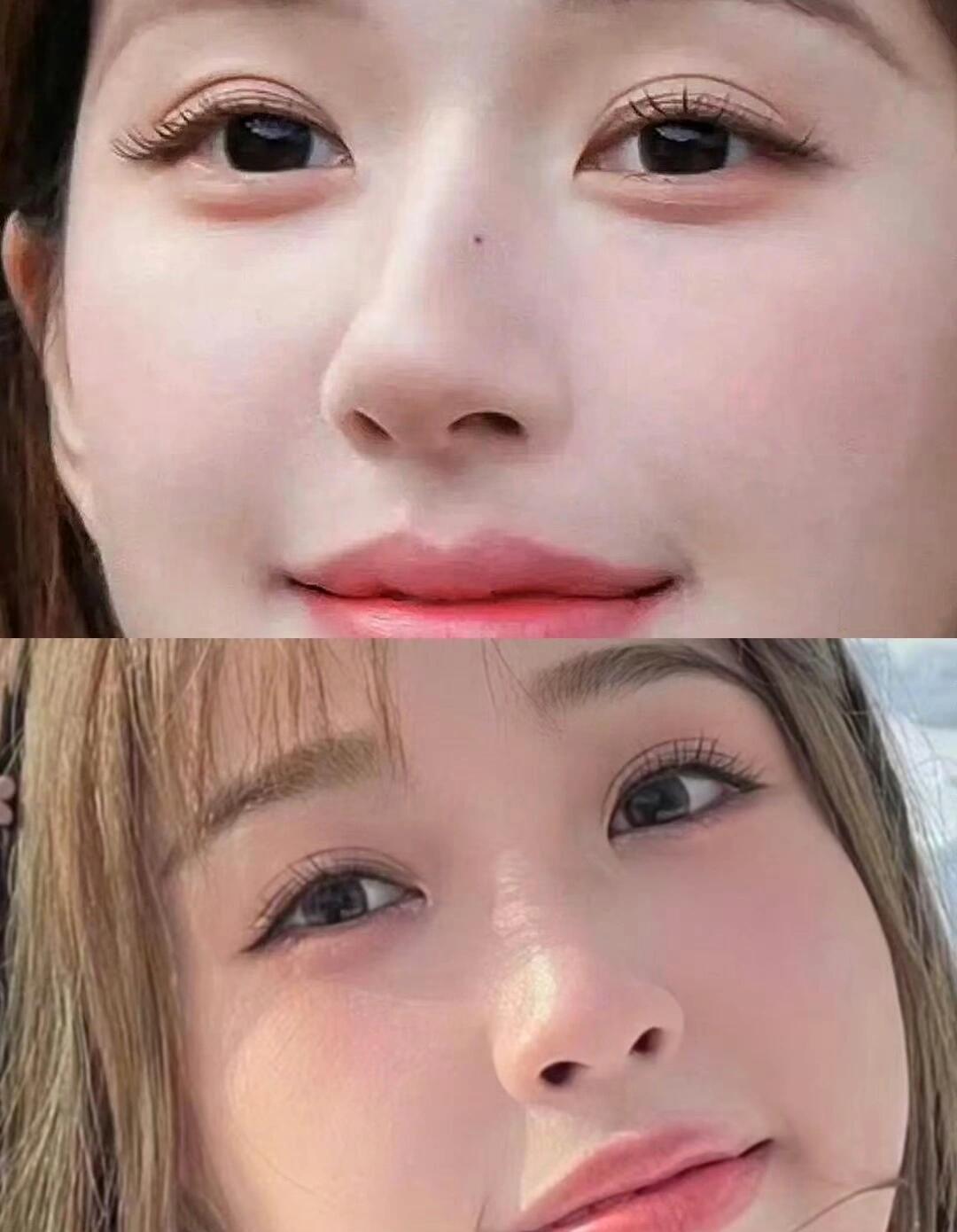 她们为啥宁愿贴双眼皮贴也不愿噶一个