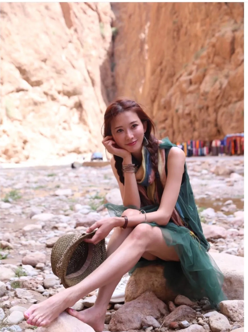 林志玲，人虽美，但拇指外翻有点严重。