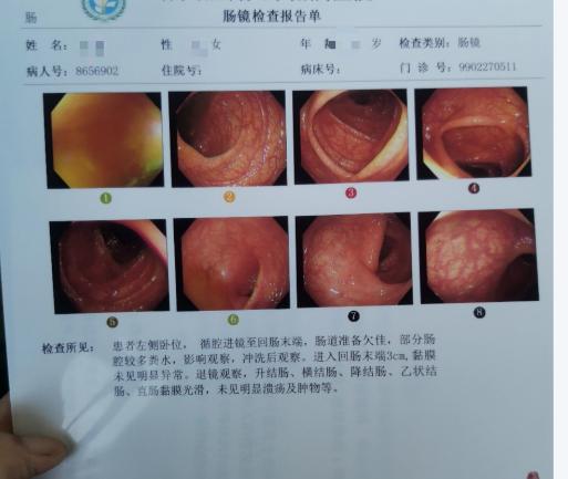 45岁还没做过肠镜？别等到有症状再行动，那时候可能已经晚了！45岁，是人体健康